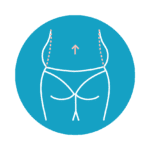 Veritas Plastic Surgery Walnut Creek BodyTite Back Lift Veritas Plastic Surgery Walnut Creek BodyTite Back Lift