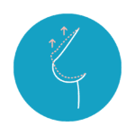 Veritas Plastic Surgery Walnut Creek BodyTite Breast Lift Veritas Plastic Surgery Walnut Creek BodyTite Breast Lift